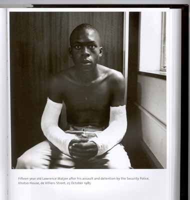 Matjee After Assault